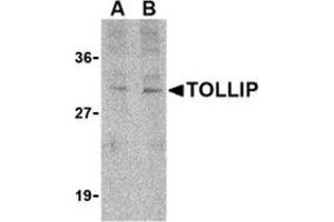 Western blot analysis of TOLLIP in rat brain cell lysate with this product at (A) 1 and (B) 2 μg/ml. (TOLLIP 抗体  (C-Term))