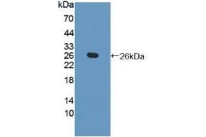 Detection of Recombinant TAGLN2, Human using Polyclonal Antibody to Transgelin 2 (TAGLN2) (TAGLN2 抗体  (AA 2-199))