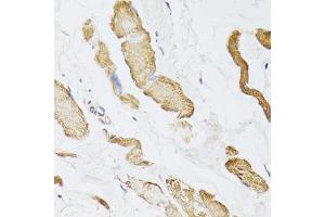 Immunohistochemistry of paraffin-embedded human esophagus using CKMT2 antibody (ABIN5975698) at dilution of 1/100 (40x lens). (CKMT2 抗体)