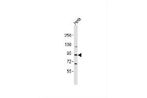 Anti-CRI Antibody at 1:1000 dilution + Hela whole cell lysates Lysates/proteins at 20 μg per lane. (RASA4 抗体)