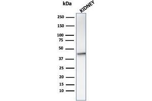 Western Blot analysis of KIdney tissue lysate using AMACR Mouse Monoclonal Antibody (AMACR/1864). (AMACR 抗体  (AA 297-394))