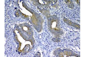 IHC analysis of MMP10 using anti-MMP10 antibody (A03759). (MMP10 抗体  (AA 239-476))