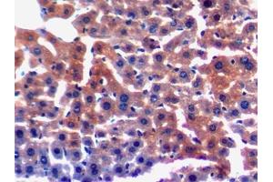 DAB staining on IHC-P; Samples: Mouse Liver Tissue (LAMC3 抗体  (AA 751-875))