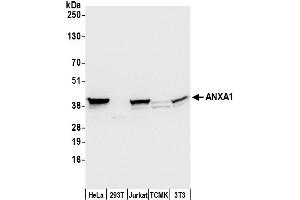 Western Blotting (WB) image for anti-Annexin A1 (ANXA1) (AA 25-75) antibody (ABIN7453914)