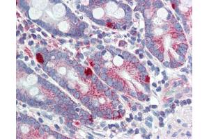 Immunohistochemistry (IHC) image for anti-Mediator Complex Subunit 4 (MED4) (C-Term) antibody (ABIN2784237) (MED4 抗体  (C-Term))