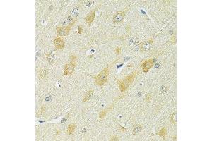 Immunohistochemistry (Paraffin-embedded Sections) (IHC (p)) image for anti-Solute Carrier Family 25 (Mitochondrial Carrier, Citrate Transporter), Member 1 (Slc25a1) (AA 1-311) antibody (ABIN6147901)