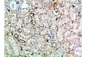 Immunohistochemistry (IHC) image for anti-Killer Cell Lectin-Like Receptor Subfamily K, Member 1 (KLRK1) (AA 167-216) antibody (ABIN7189454)