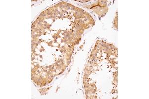 Immunohistochemical analysis of (ABIN391446 and ABIN2841429) on paraffin-embedded human testis tissue was performed on the Leica®BOND RXm. (SPAG9 抗体  (N-Term))