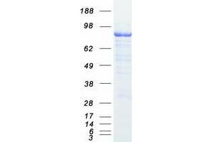 Western Blotting (WB) image for Stromal Interaction Molecule 1 (STIM1) protein (Myc-DYKDDDDK Tag) (ABIN2732852)