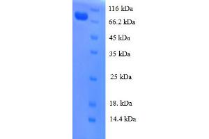 SDS-PAGE (SDS) image for Cell Division Cycle 23 (CDC23) (AA 14-591), (partial) protein (His tag) (ABIN5711947)