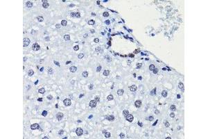 Immunohistochemistry of paraffin-embedded Mouse liver using Acetyl-Histone H2A-K5 Polyclonal Antibody at dilution of 1:100 (40x lens). (Histone H2A 抗体  (acLys5))