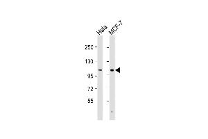 All lanes : Anti-VLDLR Antibody (C-Term) at 1:2000 dilution Lane 1: Hela whole cell lysate Lane 2: MCF-7 whole cell lysate Lysates/proteins at 20 μg per lane. (VLDLR 抗体  (AA 608-642))