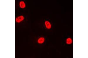 Immunofluorescent analysis of TFDP1 staining in A431 cells. (DP1 抗体  (C-Term))