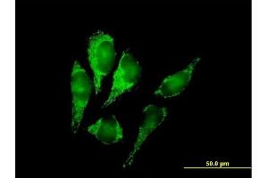 Immunofluorescence of purified MaxPab antibody to DLST on HeLa cell. (DLST 抗体  (AA 1-453))