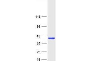Western Blotting (WB) image for Uridine Phosphorylase 2 (UPP2) (Transcript Variant 1) protein (Myc-DYKDDDDK Tag) (ABIN2735069)