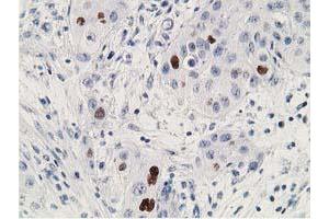 Image no. 2 for anti-Tumor Protein P53 (TP53) antibody (ABIN1499968) (p53 抗体)