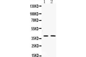 Western blot analysis of Doublecortin expression in rat brain extract ( Lane 1) and mouse brain extract ( Lane 2). (Doublecortin 抗体  (N-Term))