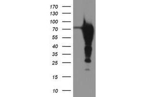 Western Blotting (WB) image for anti-Epsin 2 (EPN2) antibody (ABIN1498053) (Epsin 2 抗体)