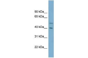 WB Suggested Anti-B4GALT2 Antibody Titration:  0. (B4GALT2 抗体  (Middle Region))