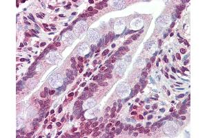 Immunohistochemistry (IHC) image for anti-ATP-Binding Cassette, Sub-Family C (CFTR/MRP), Member 8 (ABCC8) (N-Term) antibody (ABIN2781496)