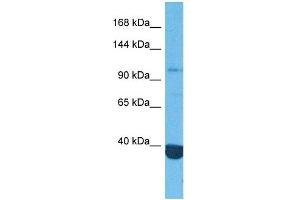 Host:  Rabbit  Target Name:  HDAC4  Sample Tissue:  Human MCF7 Whole Cell  Antibody Dilution:  1ug/ml (HDAC4 抗体  (Middle Region))