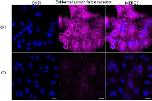 Immunocytochemical staining of HepG2 cells using Epidermal growth factor receptor antibody (ABIN7798478), 1:1,000), Top panel: wild-type (WT), Bottom panal: Adiponectin receptor 1 shRNA knockdown (KD). (Recombinant EGFR 抗体)