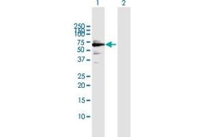 Western Blotting (WB) image for anti-SWI/SNF Related, Matrix Associated, Actin Dependent Regulator of Chromatin, Subfamily B, Member 1 (SMARCB1) (AA 1-385) antibody (ABIN520282)