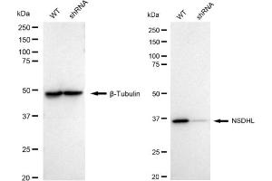 Western blotting analysis using NSDHL antibody (ABIN7799538). (Recombinant NSDHL 抗体)