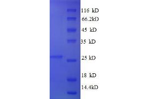 SDS-PAGE (SDS) image for TIMP Metallopeptidase Inhibitor 4 (TIMP4) (AA 30-224) protein (His tag) (ABIN5710498)