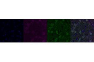 Immunohistochemistry (IHC) image for anti-Cholinergic Receptor, Nicotinic, alpha 6 (CHRNA6) antibody (ABIN7456066) (CHRNA6 抗体)