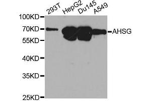 Western blot analysis of extracts of various cell lines, using AHSG antibody. (Fetuin A 抗体  (AA 19-300))