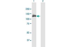 Western Blot analysis of ACLY expression in transfected 293T cell line by ACLY MaxPab polyclonal antibody. (ACLY 抗体  (AA 1-1101))