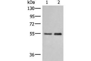 Western blot analysis of Human placenta tissue and 231 cell lysates using HTRA4 Polyclonal Antibody at dilution of 1:400 (HTRA4 抗体)