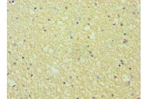 Immunohistochemistry of paraffin-embedded human brain tissue using ABIN7151874 at dilution of 1:100 (Ephrin A1 抗体  (AA 19-182))