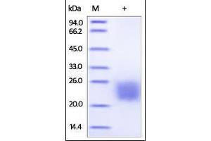 SDS-PAGE (SDS) image for Cytotoxic T-Lymphocyte-Associated Protein 4 (CTLA4) (AA 37-160) (Active) protein (His tag,AVI tag,Biotin) (ABIN2180929)