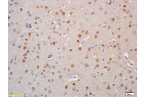 Formalin-fixed and paraffin embedded rat brain tissue labeled Anti-HSTF2/HSF2 Polyclonal Antibody, Unconjugated (ABIN686137) at 1:200, followed by conjugation to the secondary antibody and DAB staining (HSF2 抗体  (AA 401-536))