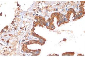 Immunohistochemistry of paraffin-embedded Human lung using HHLA2 Polyclonal Antibody at dilution of 1:100 (40x lens). (HHLA2 抗体)