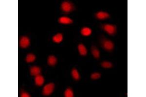 Immunofluorescent analysis of Histone H4 (AcK12) staining in A431 cells.