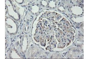 Image no. 4 for anti-Receptor (TNFRSF)-Interacting serine-threonine Kinase 1 (RIPK1) (AA 133-422) antibody (ABIN1490909)