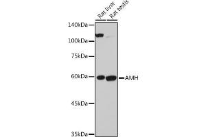 Western blot analysis of extracts of various cell lines, using AMH antibody (ABIN7265629) at 1:500 dilution. (AMH 抗体  (AA 20-280))