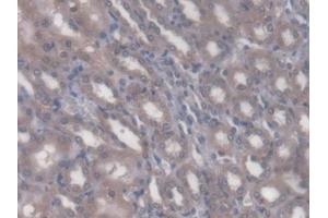 DAB staining on IHC-P; Samples: Rat Kidney Tissue (Rhotekin 抗体  (AA 296-548))