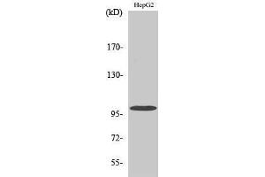 Western Blotting (WB) image for anti-Vav 2 Guanine Nucleotide Exchange Factor (VAV2) (Tyr299) antibody (ABIN3177911) (VAV2 抗体  (Tyr299))