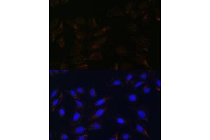 Immunofluorescence analysis of U-2 OS cells using IL13R antibody (ABIN7267987) at dilution of 1:100. (IL13RA2 抗体)