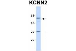Host:  Rabbit  Target Name:  KCNN2  Sample Type:  Human Fetal Lung  Antibody Dilution:  1. (KCNN2 抗体  (Middle Region))