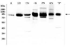 Western blot analysis of ICAM1 using anti-ICAM1 antibody (ABIN5692991). (ICAM1 抗体  (AA 28-268))