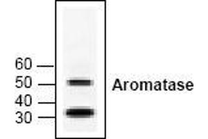 Image no. 1 for anti-Cytochrome P450, Family 19, Subfamily A, Polypeptide 1 (CYP19A1) antibody (ABIN126953) (Aromatase 抗体)