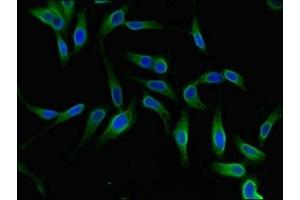 Immunofluorescence (IF) image for anti-YTH Domain Family, Member 2 (YTHDF2) (AA 201-500) antibody (ABIN7175942)
