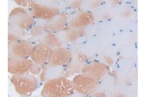 Immunohistochemistry (IHC) image for anti-Interleukin 2 (IL2) (AA 10-169) antibody (ABIN7430798)