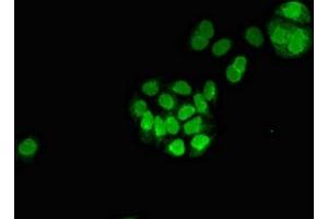 Immunofluorescent analysis of PC-3 cells using ABIN7159730 at dilution of 1:100 and Alexa Fluor 488-congugated AffiniPure Goat Anti-Rabbit IgG(H+L) (MGST3 抗体  (AA 30-70))