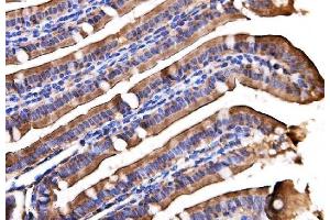 IHC analysis of AGPAT2 using anti-AGPAT2 antibody (ABIN7602435). (AGPAT2 抗体  (AA 77-178))